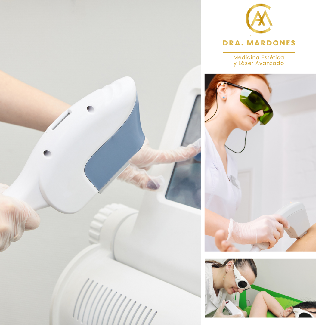 Estética Depilacion Islazul Laser Diodo Y Lactancia Depilación